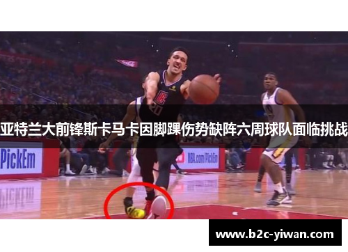 亚特兰大前锋斯卡马卡因脚踝伤势缺阵六周球队面临挑战